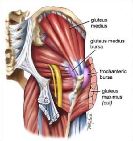 Gluteal bursitt Overbelastning/traume, hyppigst hos middelalderende kvinner Smerter i trochanter/gluteal region som stråler nedover lår og legg, ned til malleol(l4-5)