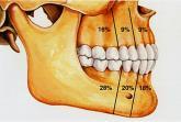 Oral and Maxillofacial Pathology 2017 Behandling