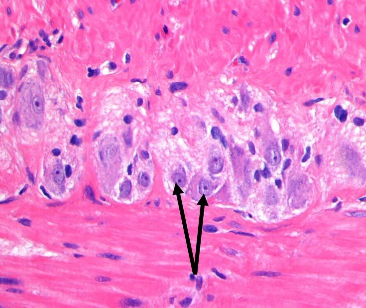 A Sympatiske ganglieceller B Slimproduserende epitelceller C X Parasympatiske ganglieceller Plexus myentericus D
