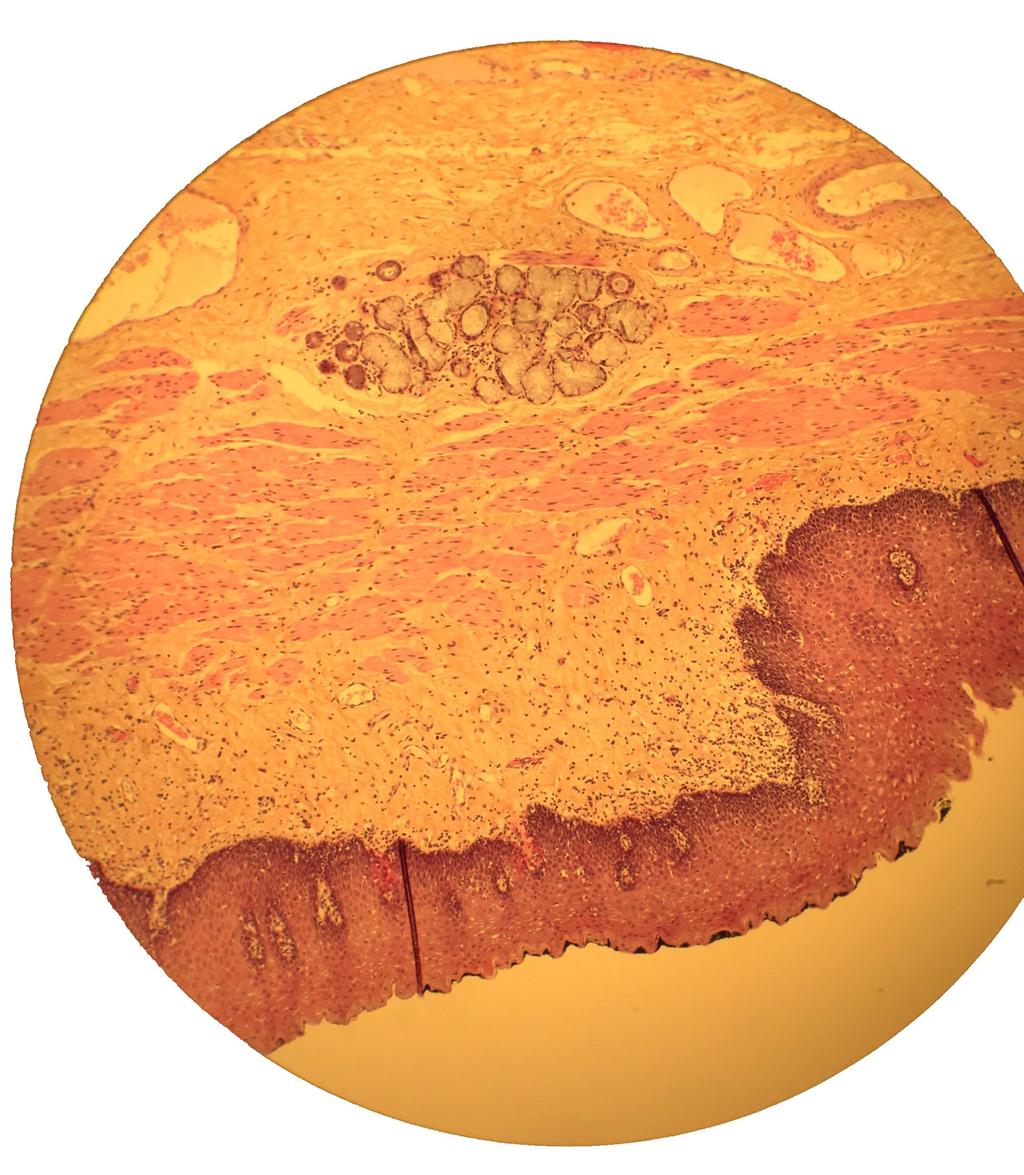 A X Øsofagus På snittet vises et tykt, flerlaget plateepitel uten keratinisering. Vi ser videre lamina propria og muscularis mucosa, og disse tre utgjør mucosa.