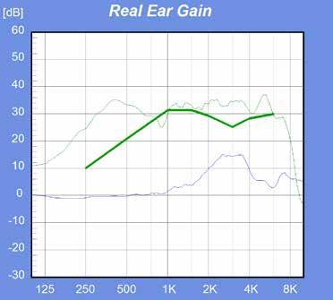 Det er den eneste lydprosessoren som brukes utenfor øret med to mikrofoner og SmartSound iq med SCAN. Man kan streame telefonsamtaler og underholdning ved hjelp av Cochlear Wireless Phone Clip.