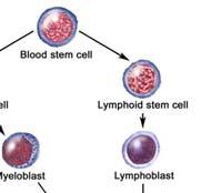 com Lymfoide progenitor celler B-ALL eller T-ALL ( >20% lymfoide