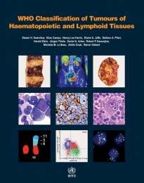 In: Hiddemann W. (eds) Handbook of Acute Leukemia.