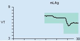 Når parameterfeltet SVC-etCO2 trykkes på, åpnes siden Trender/Data > SVC > Trend. Parameterfeltet viser klokkeslettet (A) når SVC sist endret ventilasjonsinnstillingene.