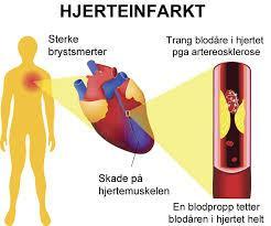 NSTEMI (Myokardinfarkt uten ST-hevning) Klinisk umulig å skille fra ustabil angina Diagnose