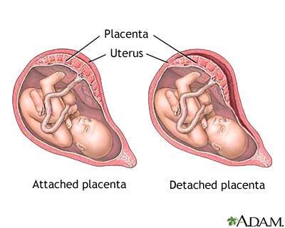 Blødninger under svangerskapet 1 av 4 som føder har hatt blødninger under svangerskapet.
