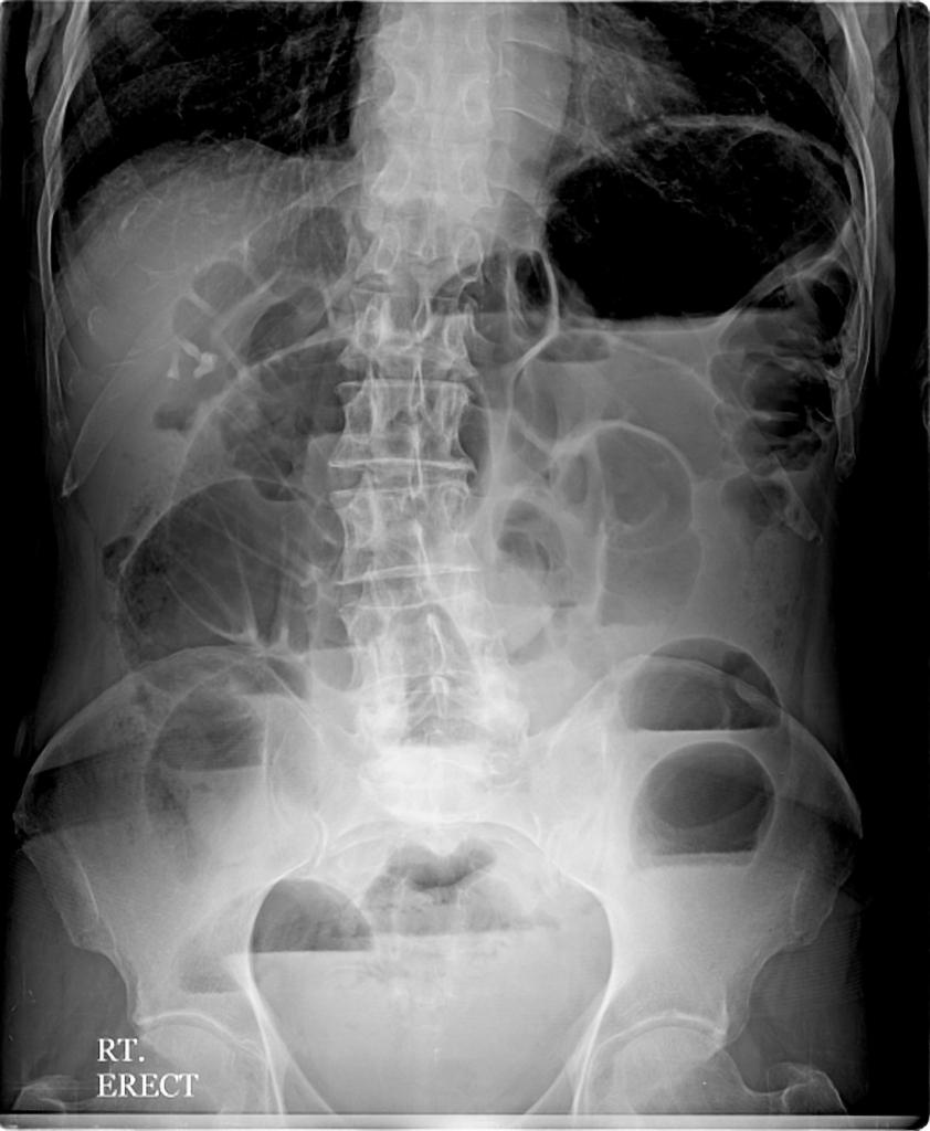 18 En tidligere frisk 66 år gammel pasient er innlagt på sykehus og det planlegges å gjøre følgende undersøkelser: en CT caput, en røntgen thorax, en MR av cervikalcolumna og en koronar angiografi.