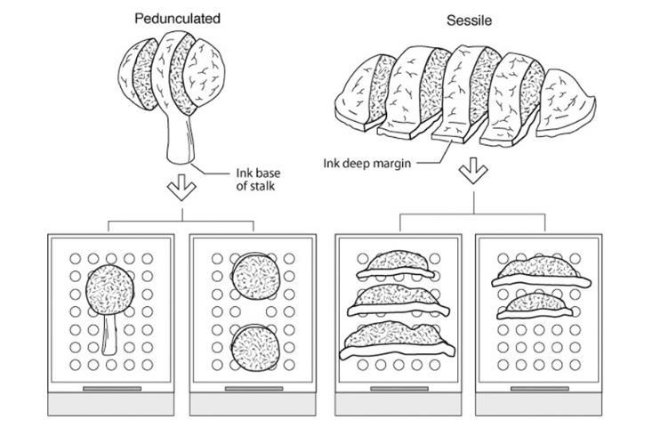 Standardisering