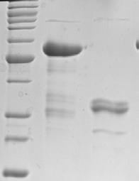 The sizes of the bands (in kda) of the BenchMark TM Protein Ladder (St) are indicated to the left and is used on all gels except for D, where the