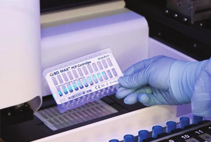 16. Plasser nødvendig antall BD MAX PCR-kassetter i BD MAX-systemet (se figur 2): Hver BD MAX PCR Cartridge kan inneholde 1 kjøring på opptil 12 prøver.