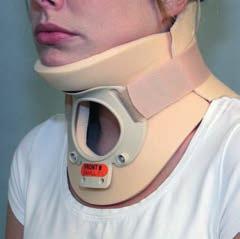 FILIP halskrage ART.NO 10117 Stabil halskrage som gir behagelig støtte og avlastning for nakke og halsvirvler. Anatomisk utformet med trakeotomiåpning. Perforert for bedre ventilasjon.
