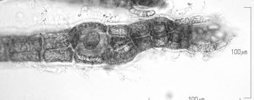 Slekten Polysiphonia Greville Tallus består av polysifone skudd med 4-24 periaksialceller. I mine prøver har jeg kun funnet arter med 4 periaksialceller.