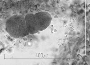 crouaniorum med sekundære poreforbindelser (eksempler merket med piler). b) Konseptakel hos L. crouaniorum med tverrdelt tetraspore. a) 25 µm b) Både denne og den påfølgende arten, T.