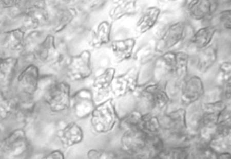 Lamouroux) Nägeli Beskrivelse: Cellene i den basale cellerekken er høye og smale og litt skråstilte (palisadeceller).
