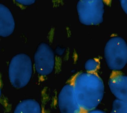 Fluorescens in situ hybridisering (FISH):