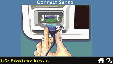Hvis sensoren kobles fra overvåkningssystemet Hvis sensoren kobles fra overvåkningssystemet, vises skjermbildet til