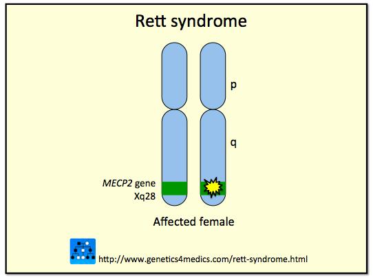 Årsak: Forandring (mutasjon) i genet MECP2 på X- kromosomet Rammer nærmest