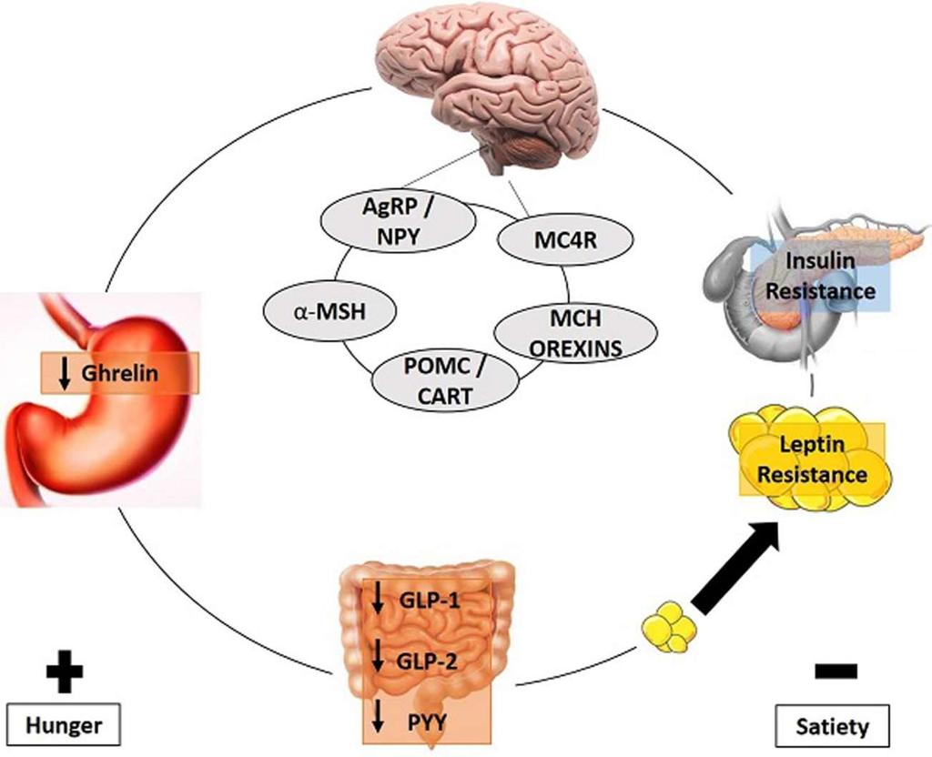 The Obese Brain AgRP: agouti-related protein; α-msh: alpha-melanocyte-stimulating hormone; MC4R: melanocortin-4 receptor; CART: