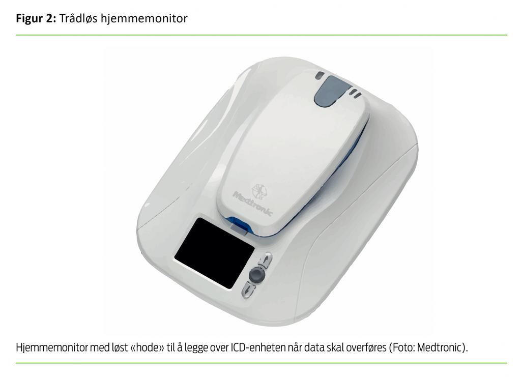 Hjemmemonitorering som ICD-leverandøren har utviklet, har litt ulike metoder for å lese av ICD-er,