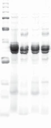 Journal of Biomedicine and Biotechnology 5 15 75 Exponential phase Stationary phase M G1 O1 G O pbr3 ori EcoRV (375) P alda EcoRI (167) pad99a (375 bp) MCS 5S rrna rrnb T1T terminator Sac I Kpn I Sma