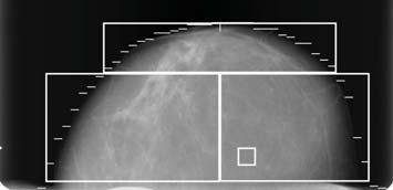 Journal of Biomedicine and Biotechnology Figure 6: Mammogram regions.