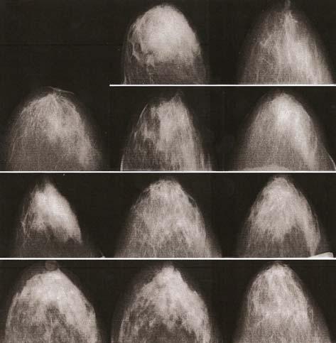 For example, EC could optimize its own subset of input feature types by processing raw image features directly.