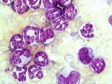 Retroviral BM transduction/transplantation model!