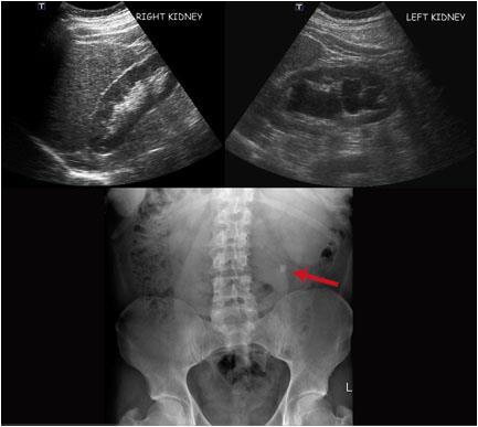 Ark 2/sheet 2 Ultralyd urinveier/ Ultrasound urinary