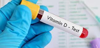 Vitamin D status Serum 25-hydroxyvitamin D (25(OH)D) markør for vitamin D-status 1 <12,5 nmol/l: Alvorlig vitamin D-mangel 2 12,5-25 nmol/l: Moderat vitamin D-mangel 2 >50 nmol/l: