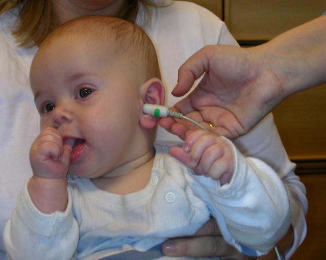 Ulike hørselstester Otoakustiske emisjoner - OAE Otoakustiske emisjoner er lyd som dannes av de ytre hårcellene i cochlea og kan måles med en mikrofon i øregangen.