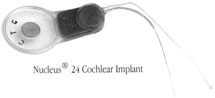 Hvordan fungerer CI? Mikrofonen bak øret tar inn lyden. Lyden bearbeides i prosessoren og sendes så trådløst via senderspolen til mottakeren i den indre del (implantatet).