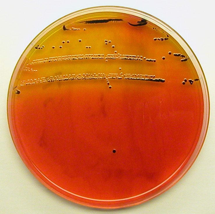 hemming av PCR prosessen som kan forårsakes av visse bestanddeler i prøvematerialet som analyseres. Laboratoriets rutiner Salmonellaanalysene startes normalt på samme dag som prøvene mottas.