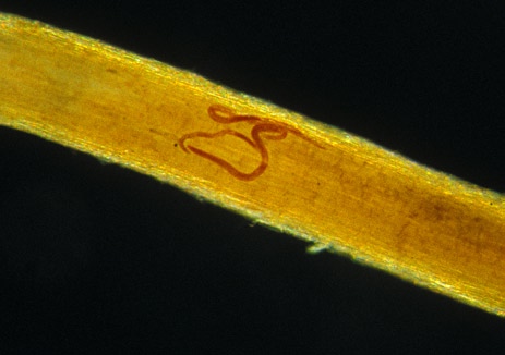 157 Rotsårnematoder Rotsårnematoder Pratylenchus spp. kan skade jordbærplanter. Særlig er det arten P.