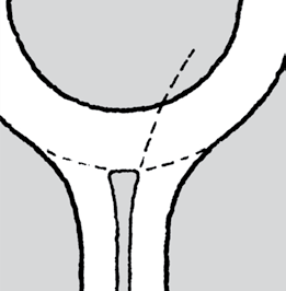 Dette medvirker til at kjøretøy som ligger til venstre i tilfarten ikke presses inn mot sentraløya, se figur 4.52.