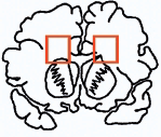 snitt fra periventrikulært vev frontalt (Fig. 18-2a) og parieto-occipitalt (Fig.