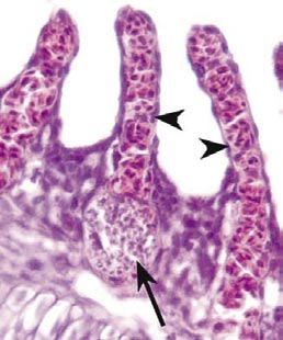 Felles for ektoparasittiske ciliater og flagellater er at de irriterer hud og gjeller og kan gi alvorlige betennelser og dødelighet.