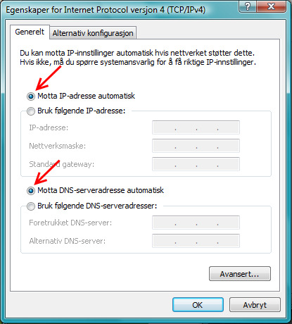 Velg Motta IP-adresse automatisk og Motta DNS-serveradresse automatisk Klikk OK.