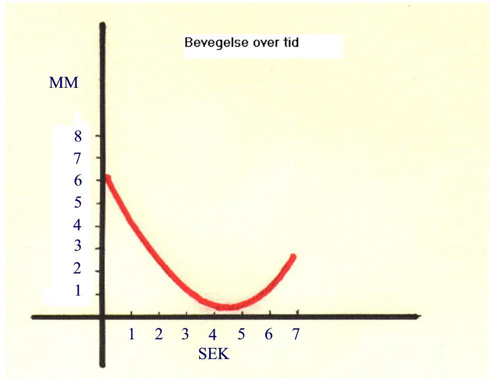 26 26 blodet som pulserer i årene, som fører til uro. I tillegg til dette kommer effekten av vind når du skyter utendørs.