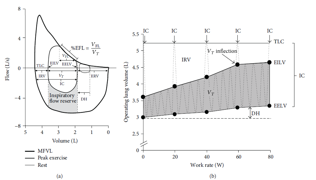 (O'Donnell and Laveneziana, 2006). En kan da si at EELV kalkuleres som TLC minus IC.