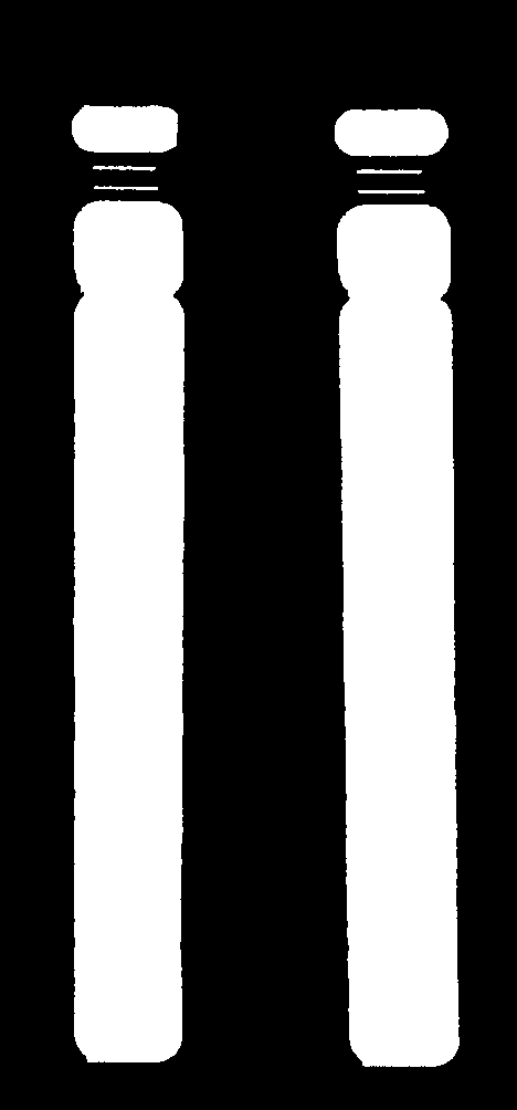 p q q13 FIG. 16 Ideogram som viser isodisentrisk (idic) 15 (til høyre) med to kopier av deler av et kromosom og to normale kromosomer 15 (til venstre).