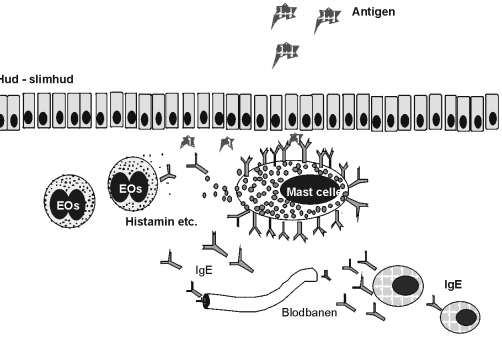 Figur 2. Skjematisk fremstilling av type I immunreaksjon. Antigenene kommer igjennom slimhinnen og binder seg til IgE molekyler på overflaten av mastceller.