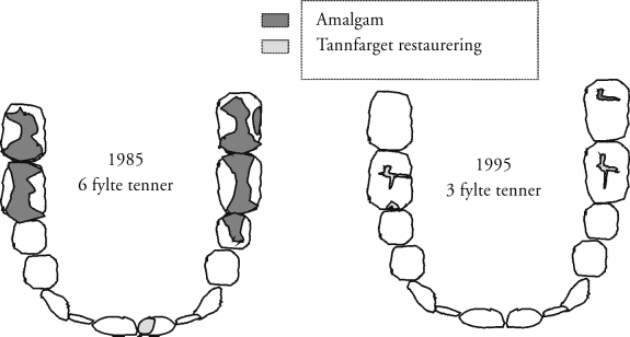 Det fremgår av Figur 2 at personer med høyere alder har flere fylte flater totalt, flere flater fylt med amalgam, og høyere andel av alle fylte flater utgjøres av amalgam.