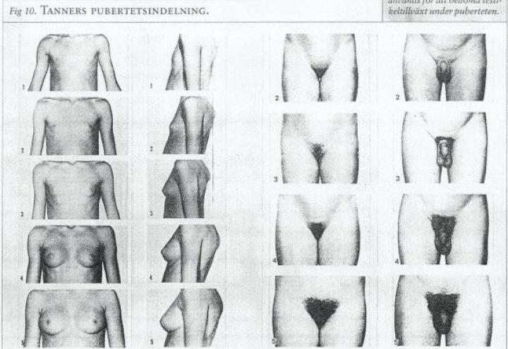 Vedlegg 3: Tanners tabell for pubertetsinndeling Kilde: Trond