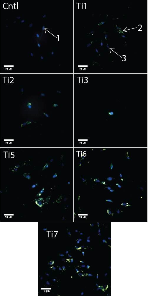 Figur 3: Mørke felt mikroskopi av gingivale fibroblaster etter 48 timer eksponert med titandioksid nanopartikler.
