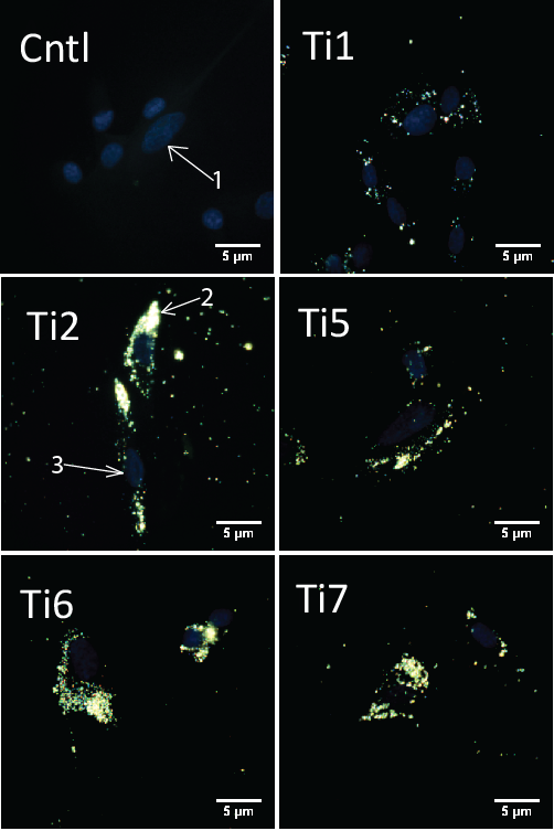 Figur 4: Mørke felt mikroskopi av gingivale fibroblaster etter 48 timer eksponert med titandioksid nanopartikler. Bildene er tatt med 100x olje-nedsenket objektiv.