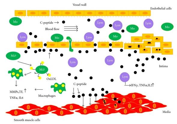 Inflammasjon via C-peptid Hypotese: Økt nivå av C-peptid, som en ser