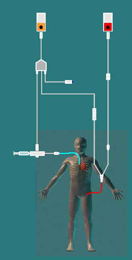 Måle C.O. med PiCCO-metoden 13 Overvåke cardiac output Klargjøre PiCCO-målingen 1 Klargjør arterietrykksettet med arteriekateter (transpulmonalkateter) og trandusersett fra Pulsion Medical Systems.