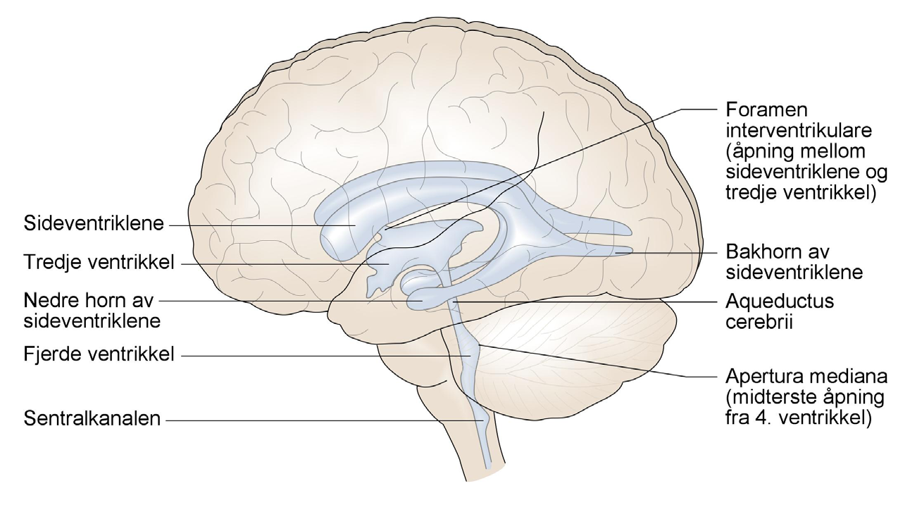 KORT OM HYDROCEPHALUS ( VANNHODE ) BEHANDLINGSALTERNATIVER Hydrocephalus er en tilstand med økt hjernevæske (CSF) og dermed utvidelse av hjernens naturlige hulrom (ventrikkelsystemet).