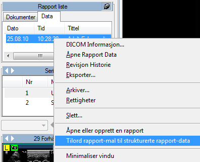 Hvis rapporten ikke var generert av en ComPACS Review Station eller ComPACS measurement import plugin, men ble mottatt direkte fra en 3dje-parts mal, klikker man da på rapport objektet vil det komme