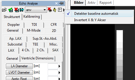 10.3.3 BEREGNINGER OG FORMLER Programvaren tilbyr ikke bare det å kunne utføre direkte målinger, men kan også beregne utledede parametre ved å bruke forskjellige matematiske formler.